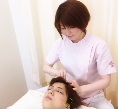 美容鍼灸の施術イメージ